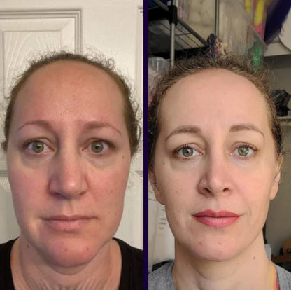 Last Chance!🎉 60% OFF Firming Enhancer – Pore Minimizer, Wrinkles & Fine Lines Reduced + Free Applicator Included!