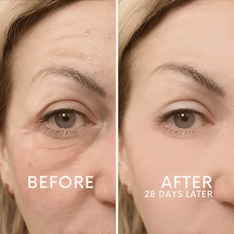 Last Chance!🎉 60% OFF Firming Enhancer – Pore Minimizer, Wrinkles & Fine Lines Reduced + Free Applicator Included!