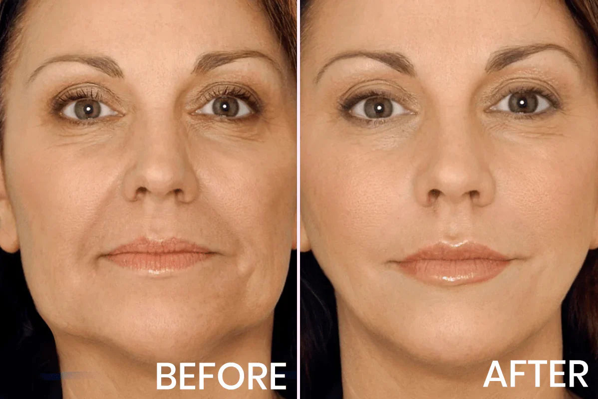 Last Chance!🎉 60% OFF Firming Enhancer – Pore Minimizer, Wrinkles & Fine Lines Reduced + Free Applicator Included!